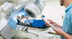 The Effect of Radiotherapy Treatment on Cancer Patients