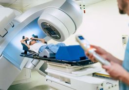 The Effect of Radiotherapy Treatment on Cancer Patients