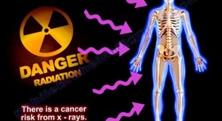 radiation risks