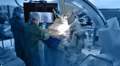 Radiation Protection